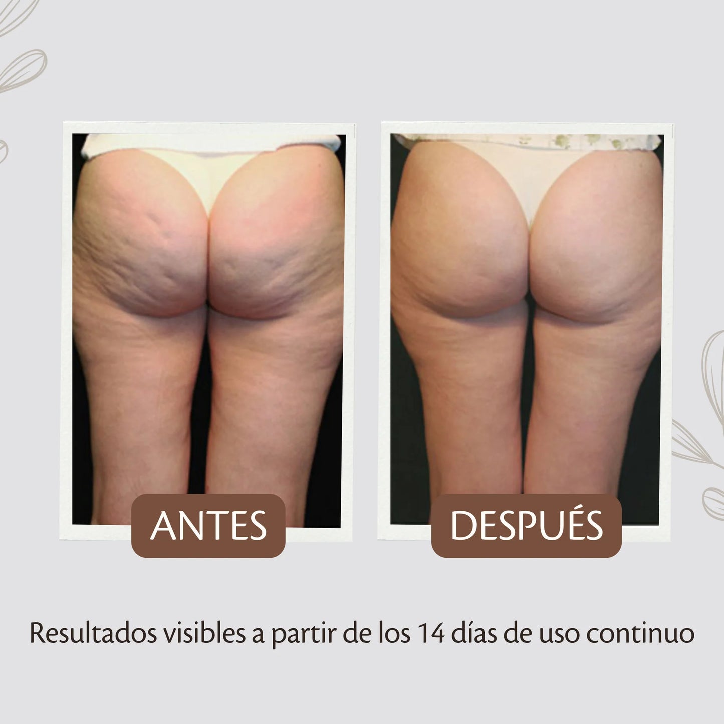 Aceite Anticelulitis Reafirmante Corporal – Tratamiento Tonificante y Moldeador