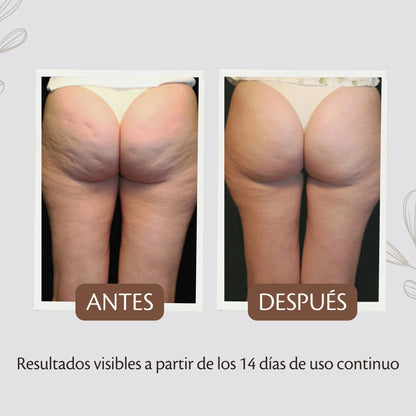 Aceite Anticelulitis Reafirmante Corporal – Tratamiento Tonificante y Moldeador